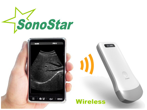 Escáner en PC del ultrasonido del ordenador portátil de la máquina SS-9 del ultrasonido 3D